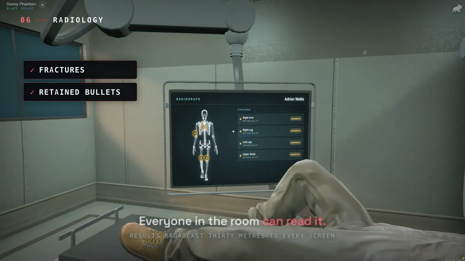In-world x-ray screen on a hospital wall showing a skeleton highlight and a findings list of moderate retained bullets in the right arm, right leg, left leg, and upper body, viewed from the patient's bed