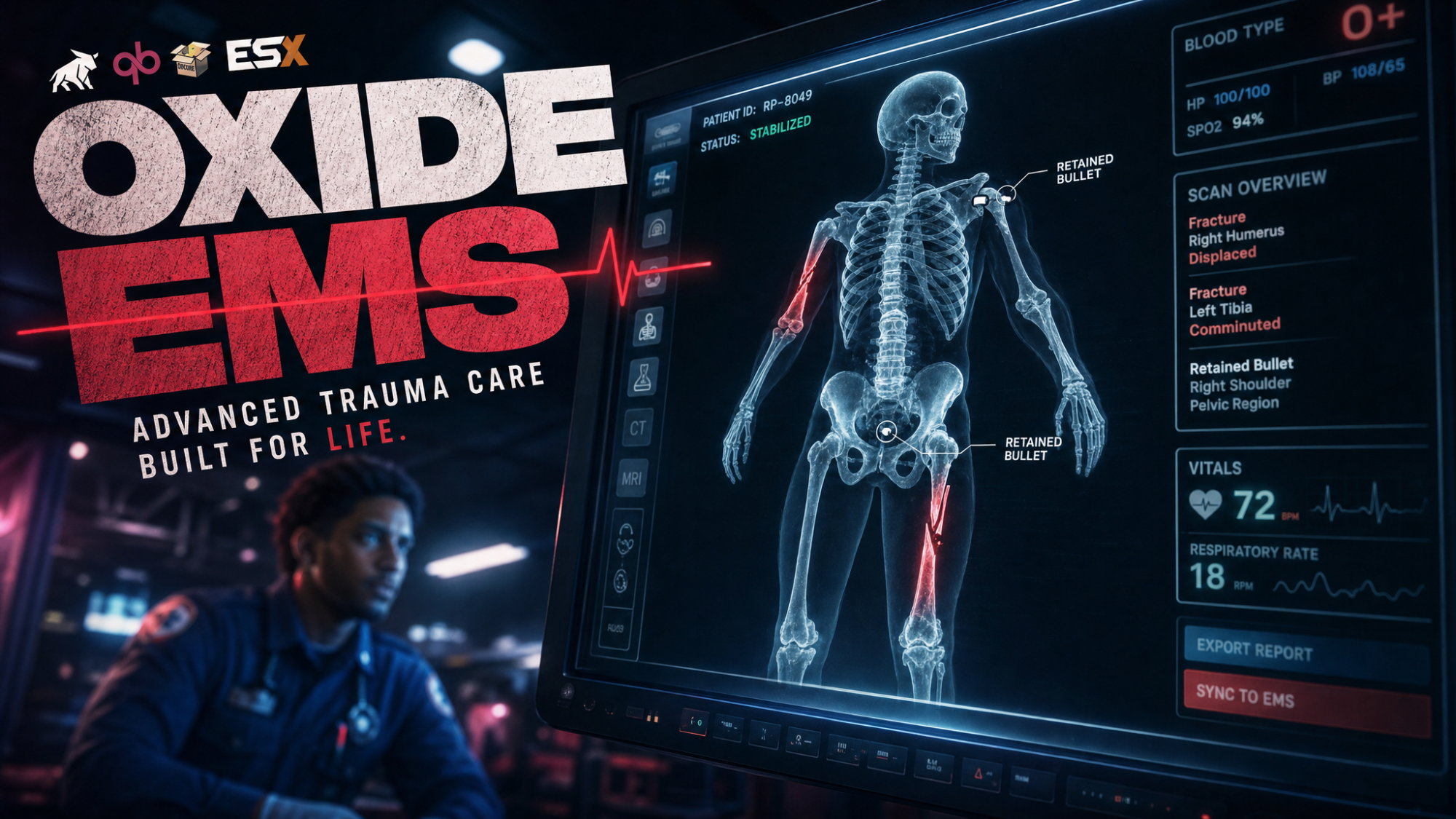 OXIDE EMS